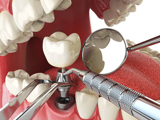 Best After-Hours Emergency Dentist in Montpelier, VT